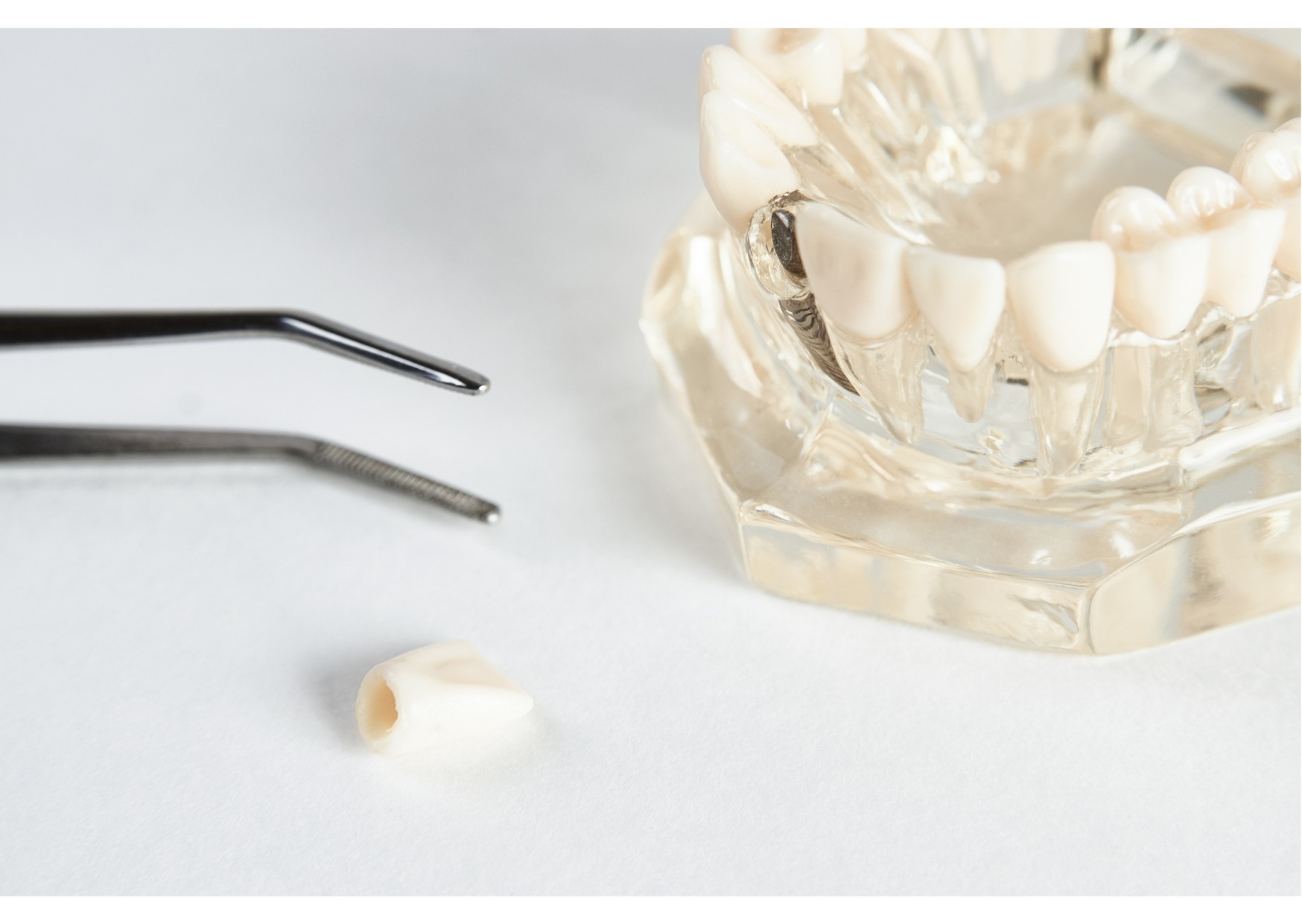 Single tooth implant model with dental tools and replacement crown for missing tooth restoration