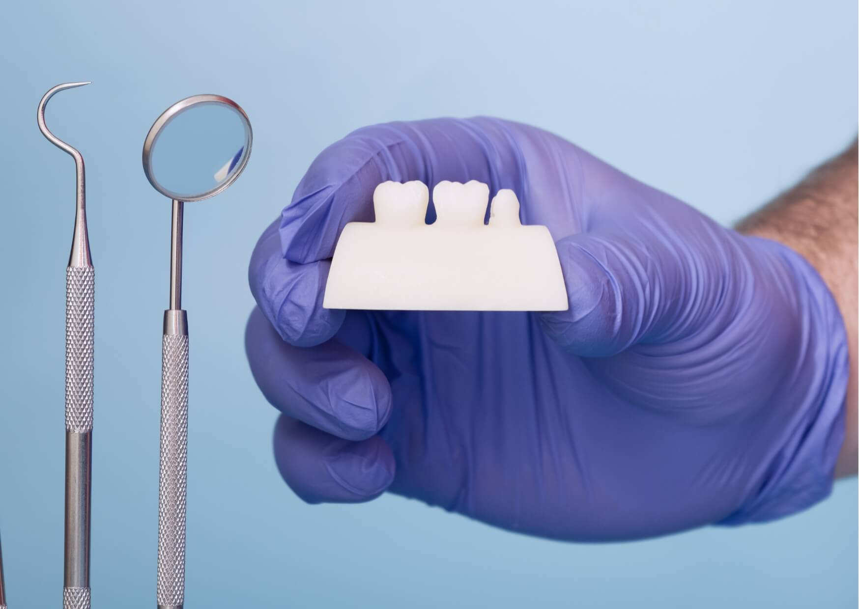 Dental model comparing a full dental crown and a porcelain veneer to explain the difference between crowns and veneers.